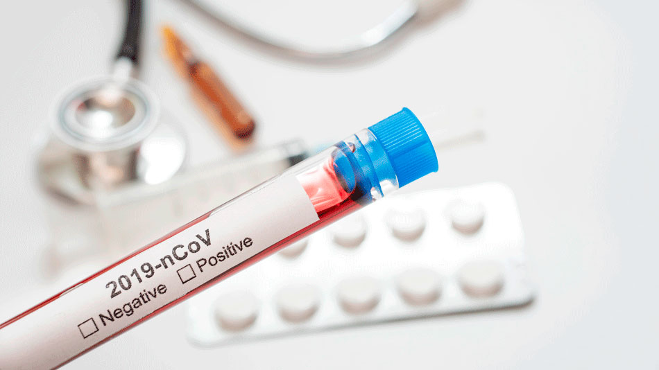Test masivos, desescalada y geolocalización frente al coronavirus