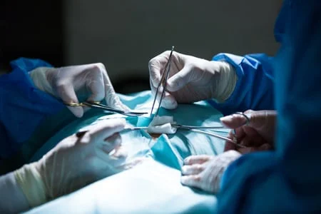 Primeras tendencias del trasplante de corazón con pacientes Covid-19 positivos