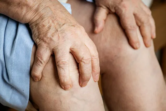Tipos de esclerodermia