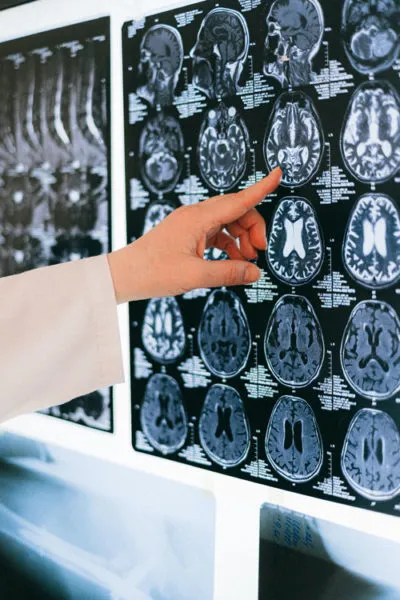 ¿Es realmente posible la Regeneración Neuronal? ¿Existe plasticidad sináptica?