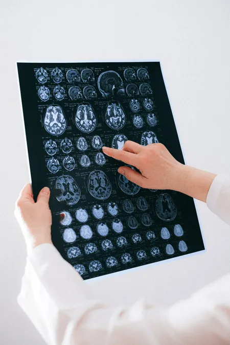 Entendiendo al cerebro