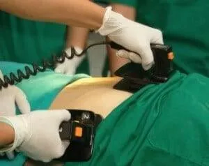 Técnica