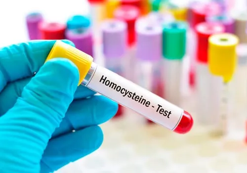 Homocisteína