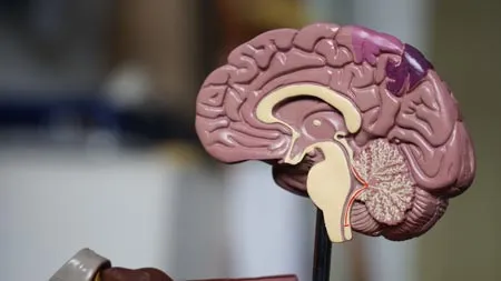 ¿Cuál es el tratamiento del ictus?