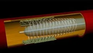 Stents Biodegradables