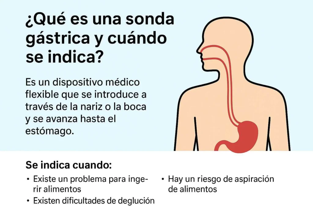 ¿Qué es una sonda gástrica y cuándo se indica?