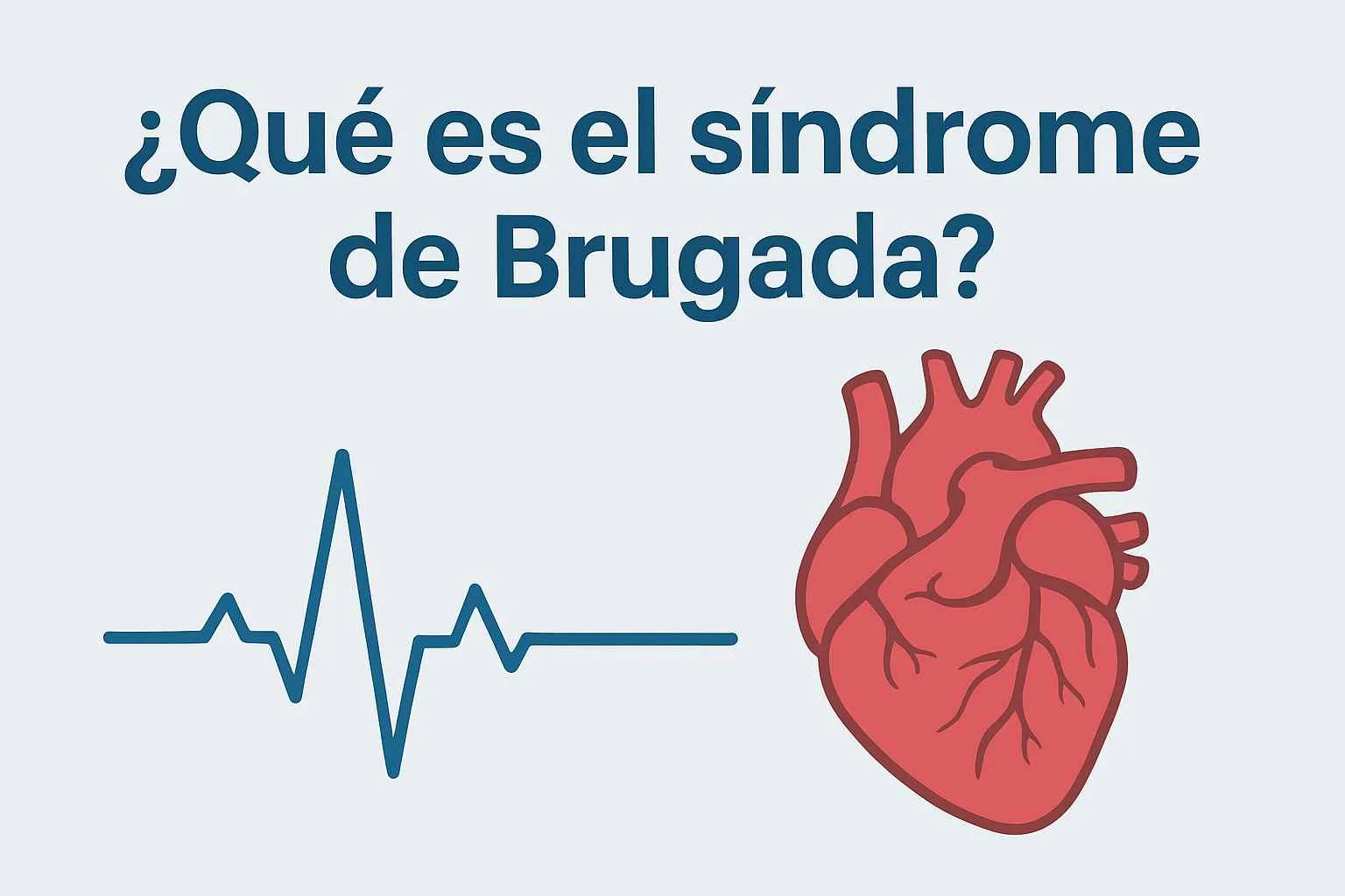 ¿Qué es el síndrome de Brugada?