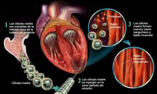 Células madre y regeneración cardiovascular